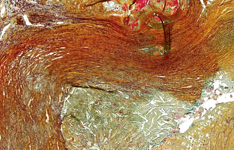Online Pathology Information